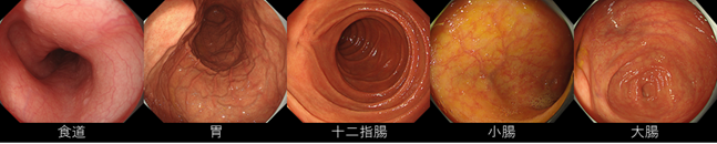 消化管-a-1
