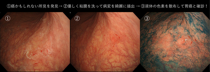 消化管-a-6
