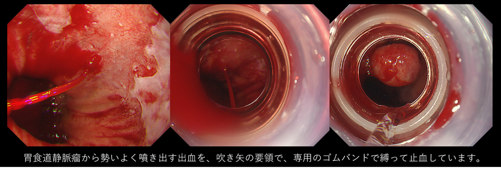 消化管-e-2