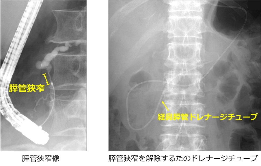 胆膵-k-1