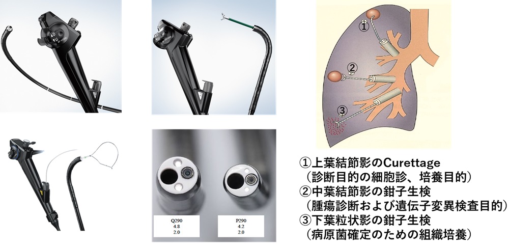 呼吸器-s-1