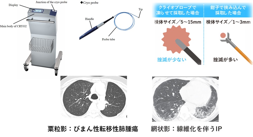 呼吸器-t-3