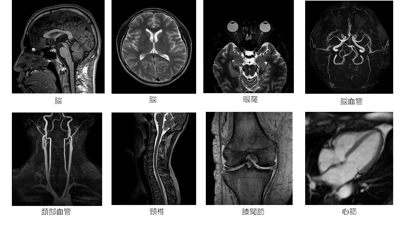 mri1.JPG
