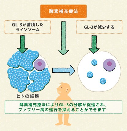 ファブリー病