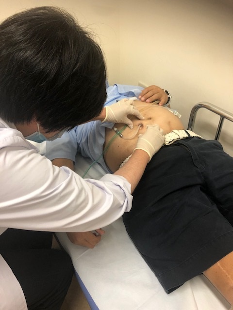PD室での腹膜透析外来
