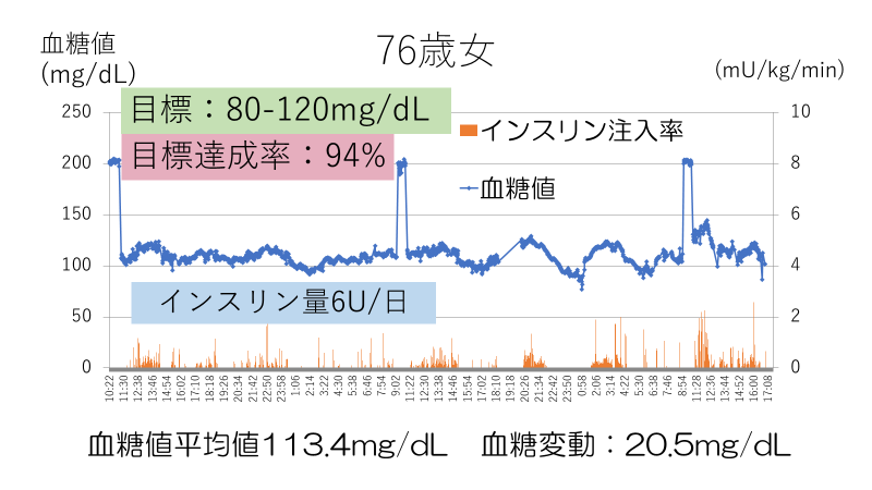 人工膵臓関連のデータもしくはグラフ