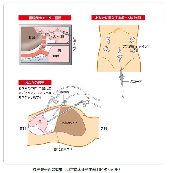 fig_4_11.jpg