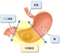 fig_4_2.jpg