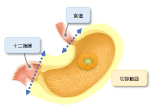fig_4_4.jpg