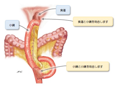 fig_4_5.jpg