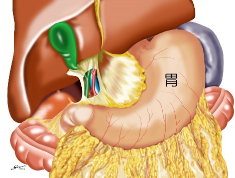 fig_5_1.jpg