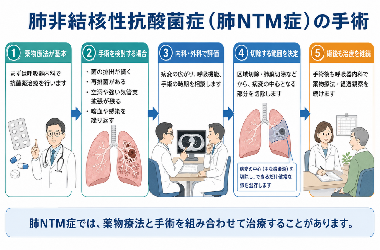 肺非結核性抗酸菌症(肺NTM症)の手術
