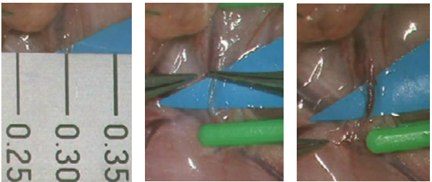 切断組織再接着・欠損組織再建_1