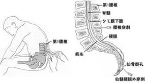 麻酔方法