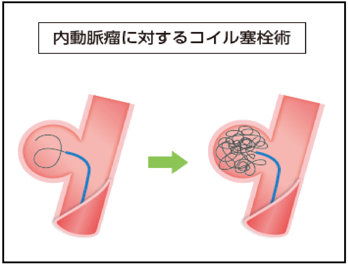 fig_2