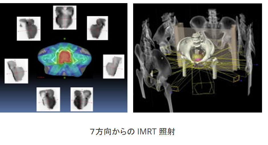 RT16.png