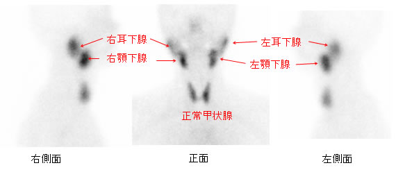 図1　正常例