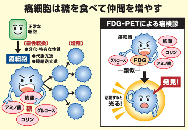 癌細胞は糖を食べて仲間を増やす