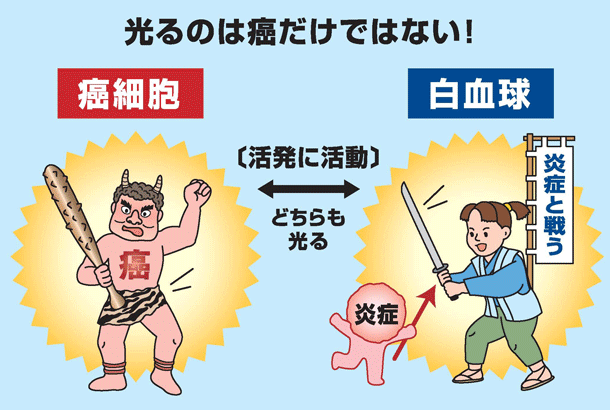 光るのは癌だけではない！