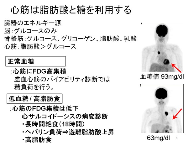 心筋は脂肪酸と糖を利用する