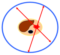 PET/CT2