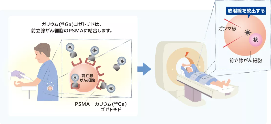 psma2