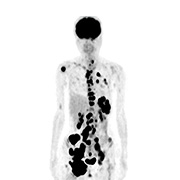 PET-CT