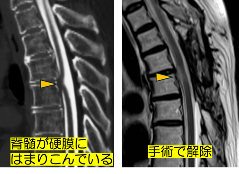 disease-05-9.png